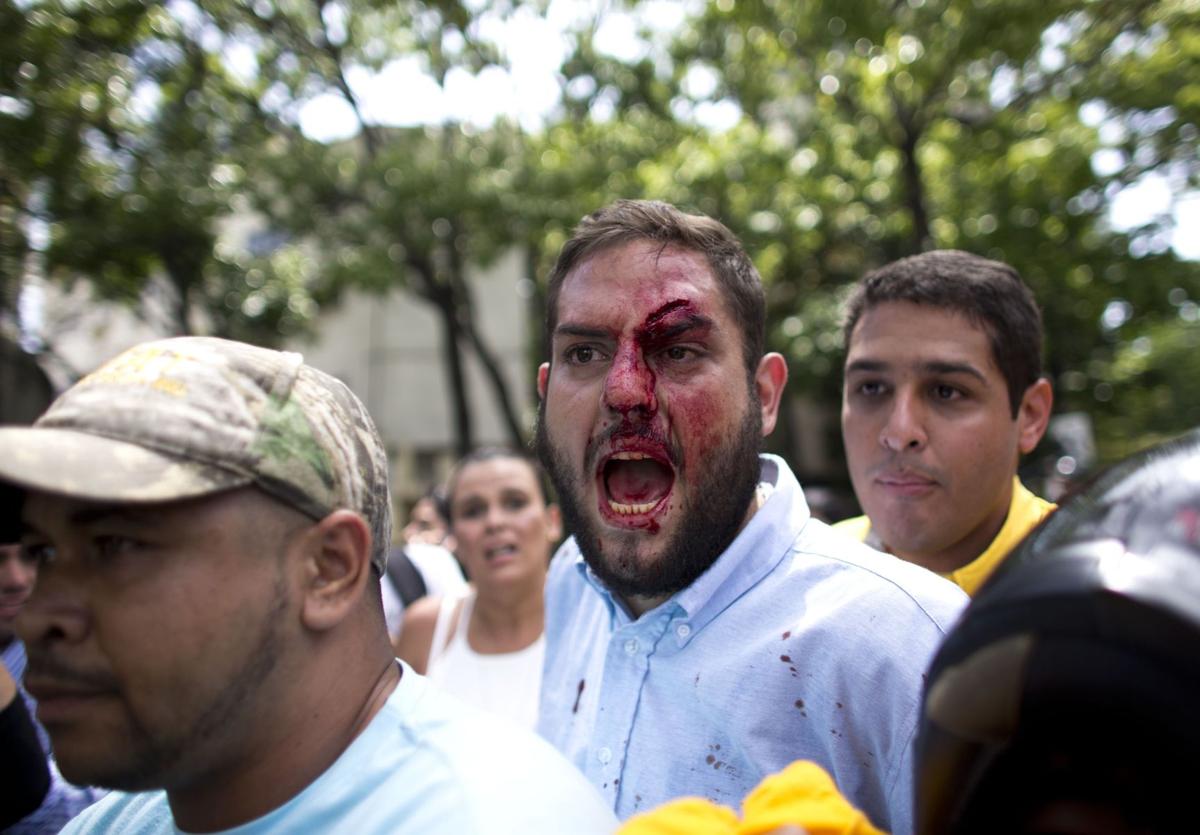 APTOPIX Venezuela Political Crisis