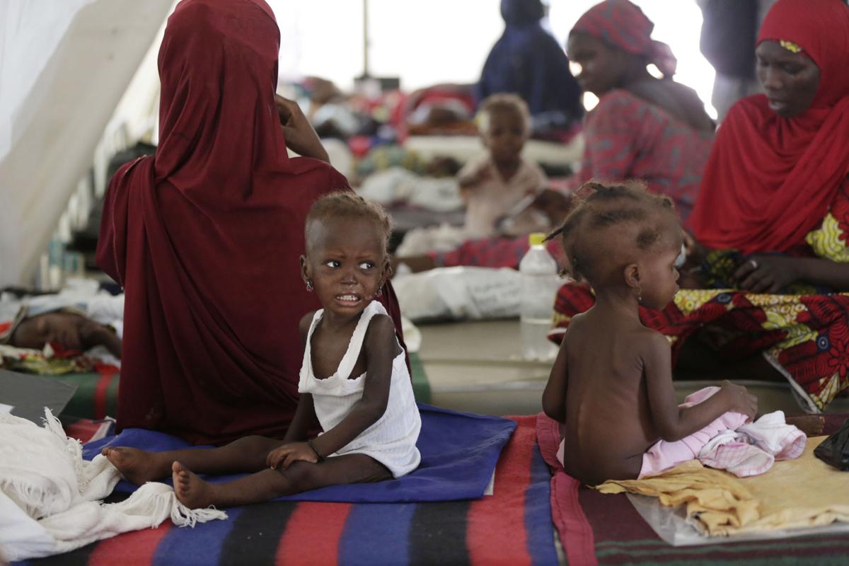 Nigeria Starving Children