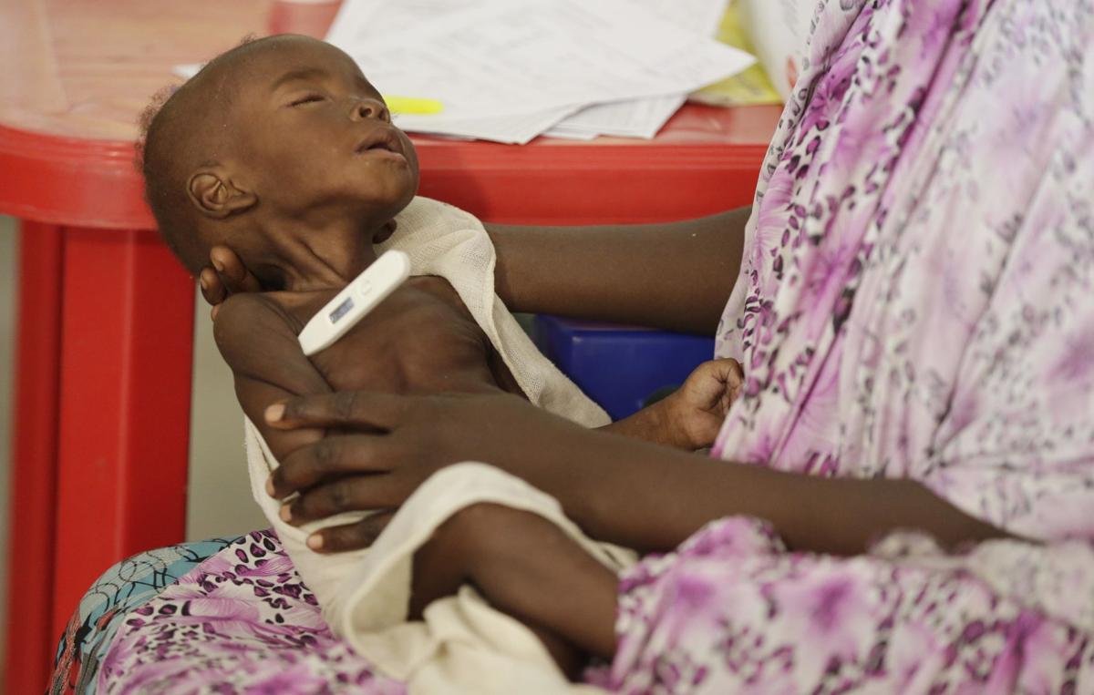 APTOPIX Nigeria Starving Children
