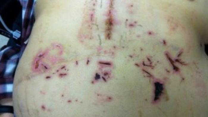 lakota man sues rapid city regional hospital over surgical rapid city regional hospital my chart