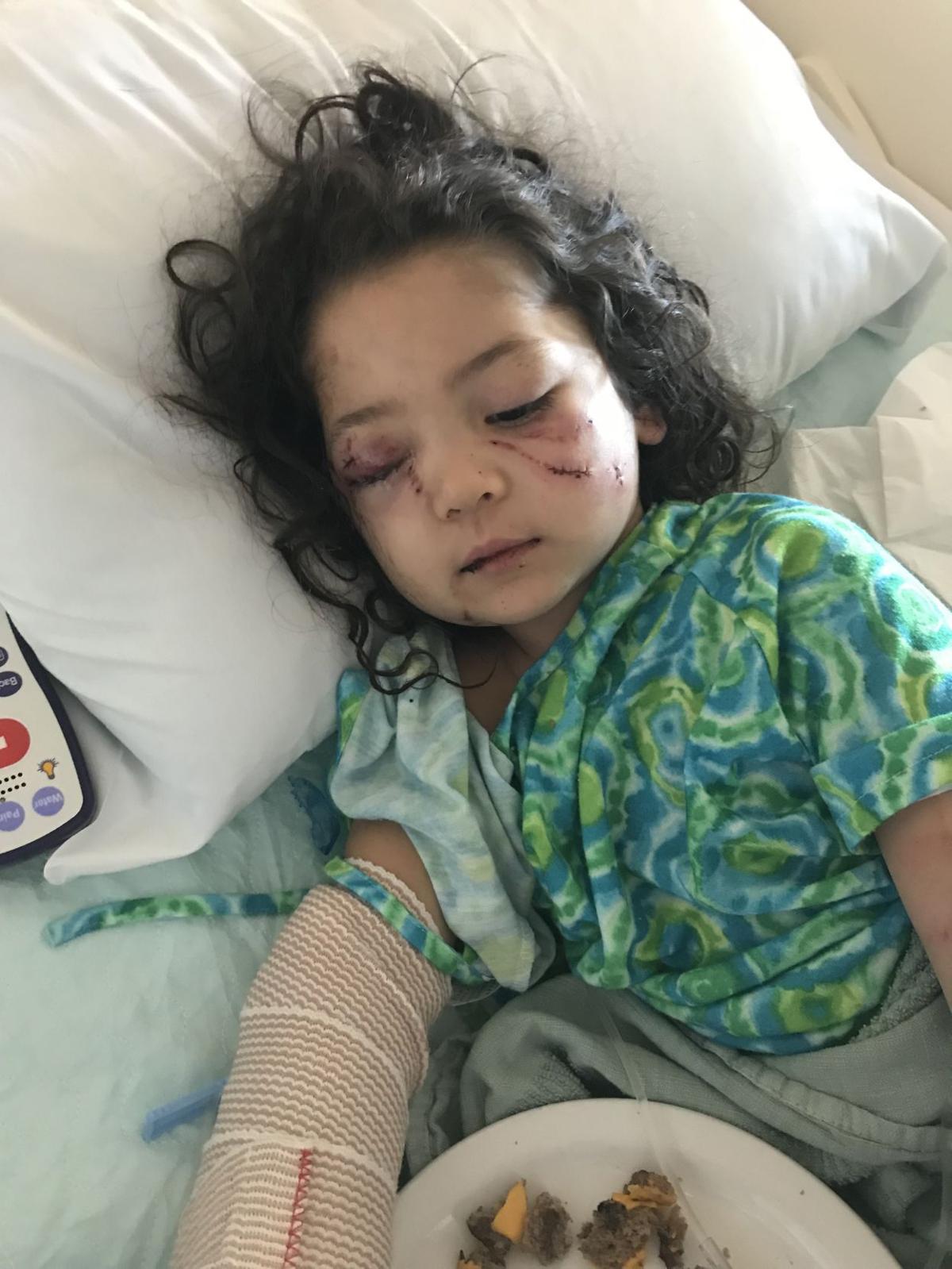 Toddler flown to Colorado after dog attack at Billings day ...