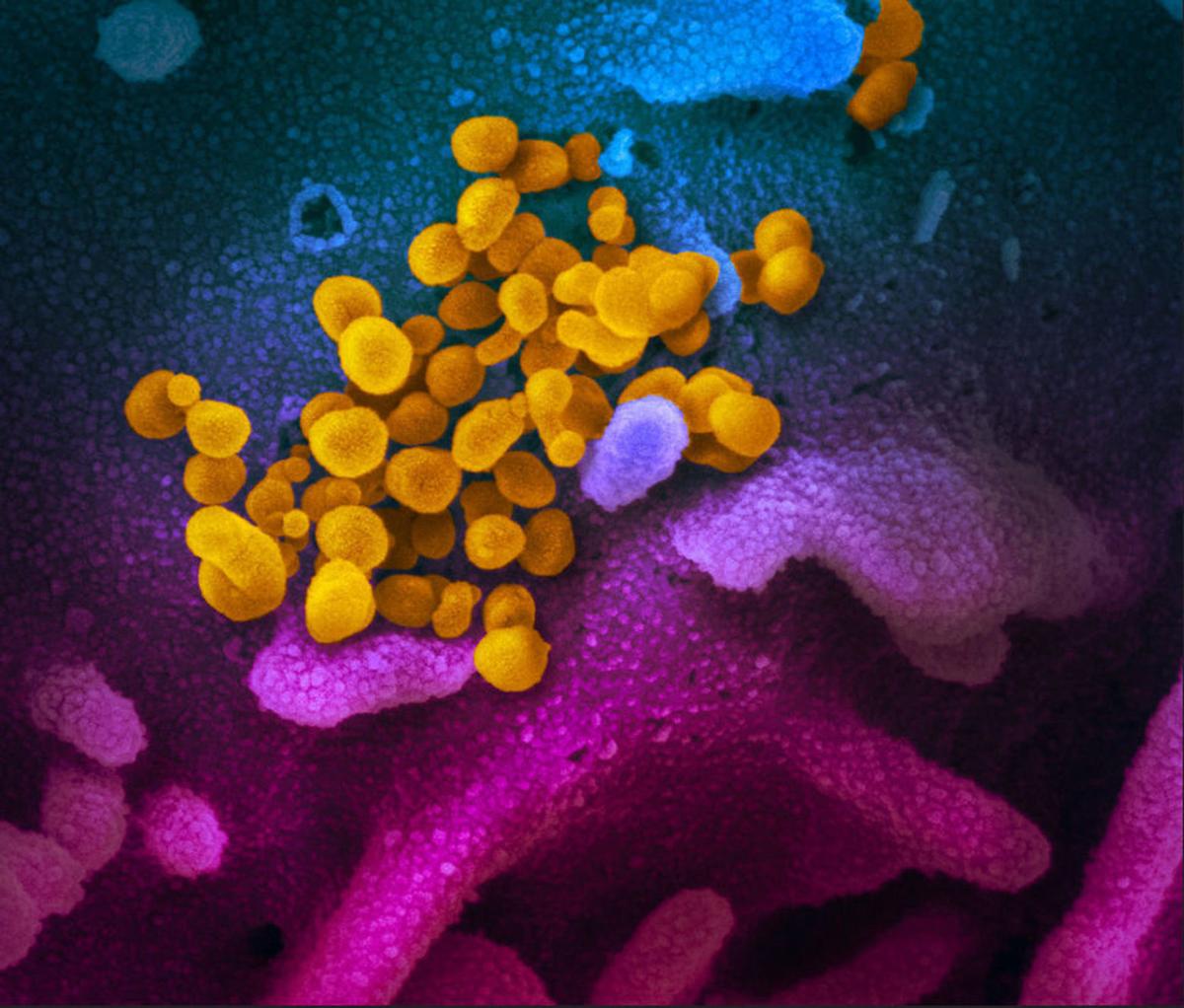 COVID-19 electron microscope scan