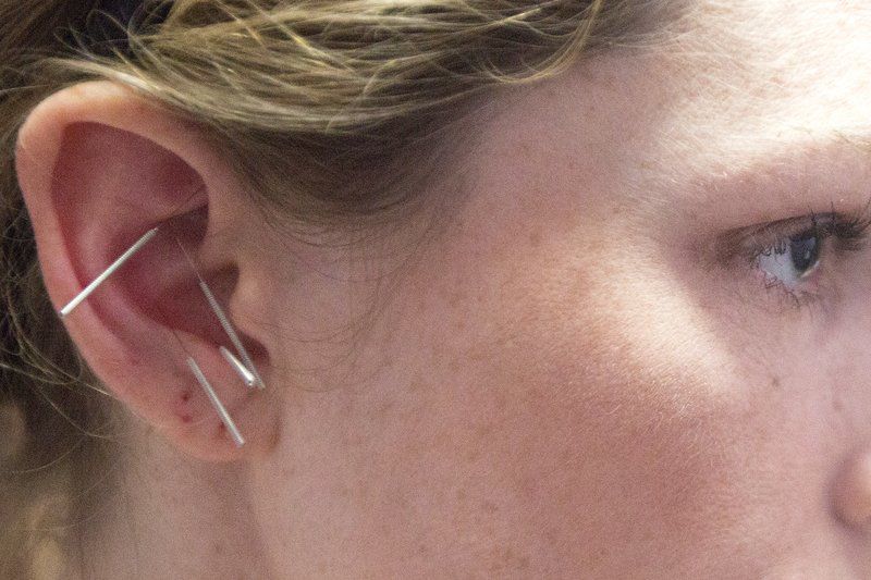 Needles keep addiction at ear's length Local News