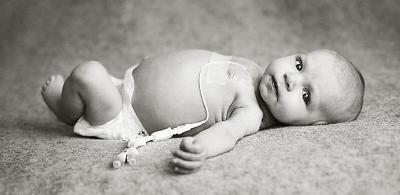 Infant Needs Treatment For Cancer Community Record Eagle Com