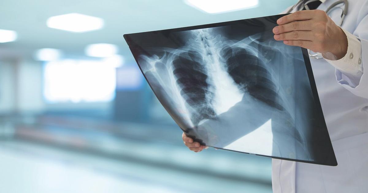 Wvjc Radiologic Program WVJC launches new online/hybrid radiologic technology program | Local ...