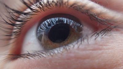 Dyslexia Is Very Treatable So Why Arent >> Dyslexia Possibly Caused By Treatable Eye Deformity Don T Dyslexia Is Very Treatable So Why Arent >> Dyslexia Possibly Caused By Treatable Eye Deformity Don T