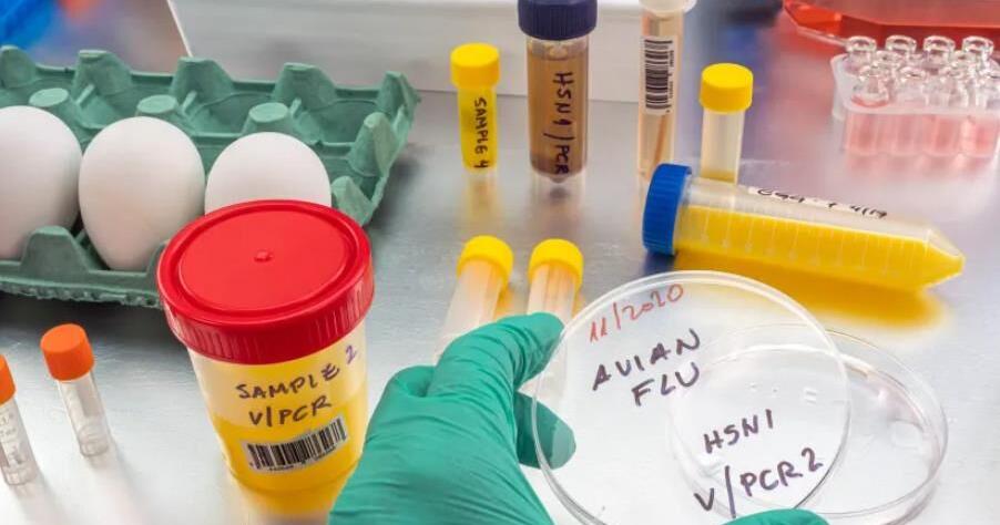 Bird flu bad for poultry and dairy cows; no dire threat for humans - yet - Vimarsana News