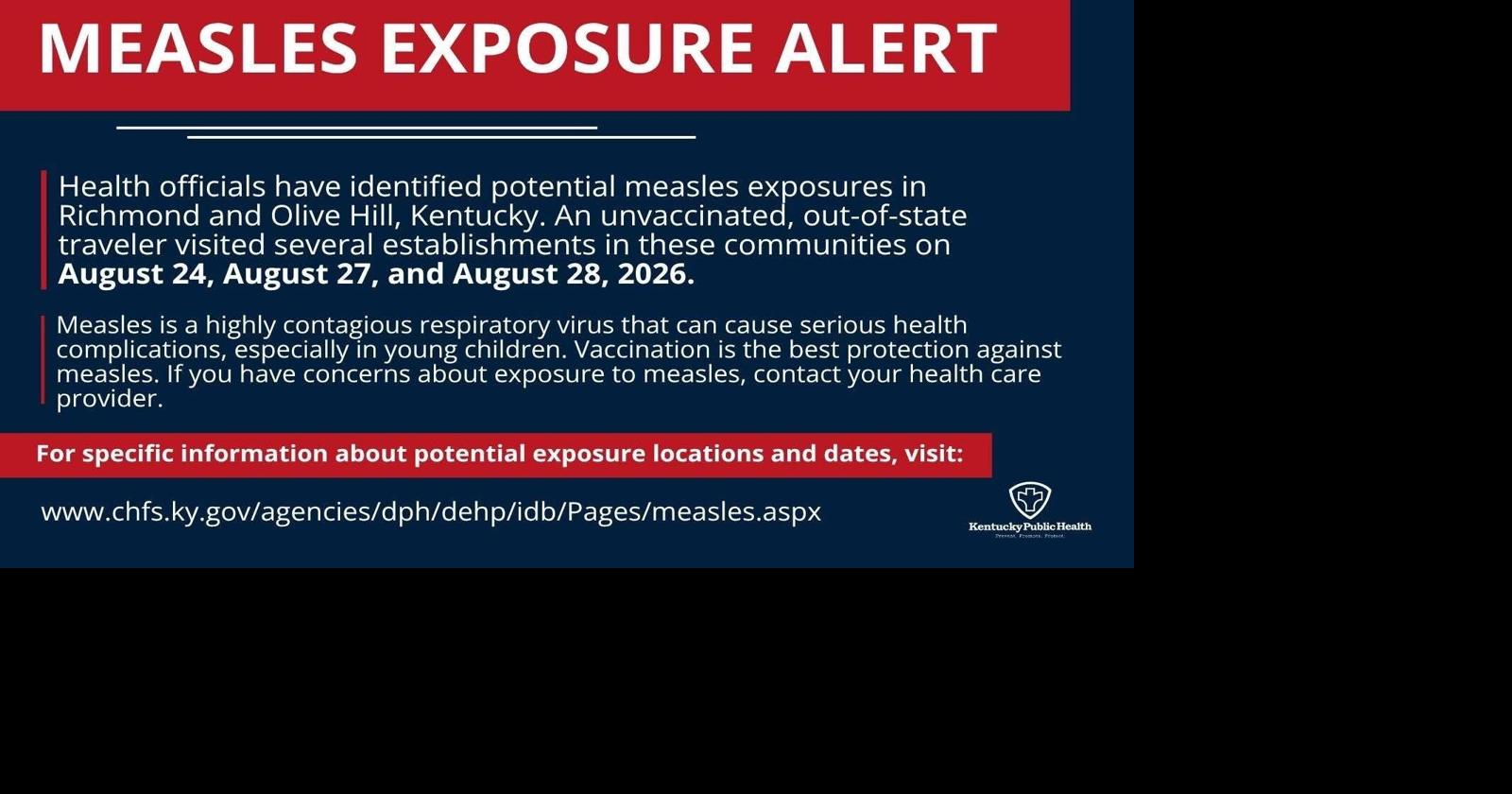 Potential measles exposure in Richmond