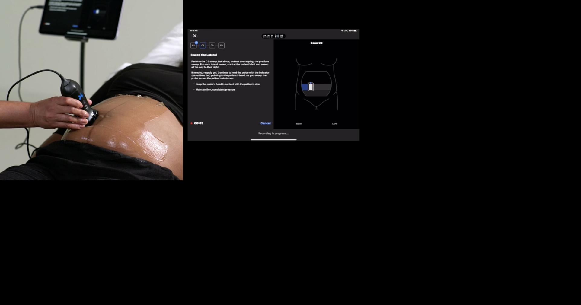 Butterfly Network Secures First FDA Clearance for Blind Sweep Ultrasound AI Tool, Marking a Major Stride for Women’s Health