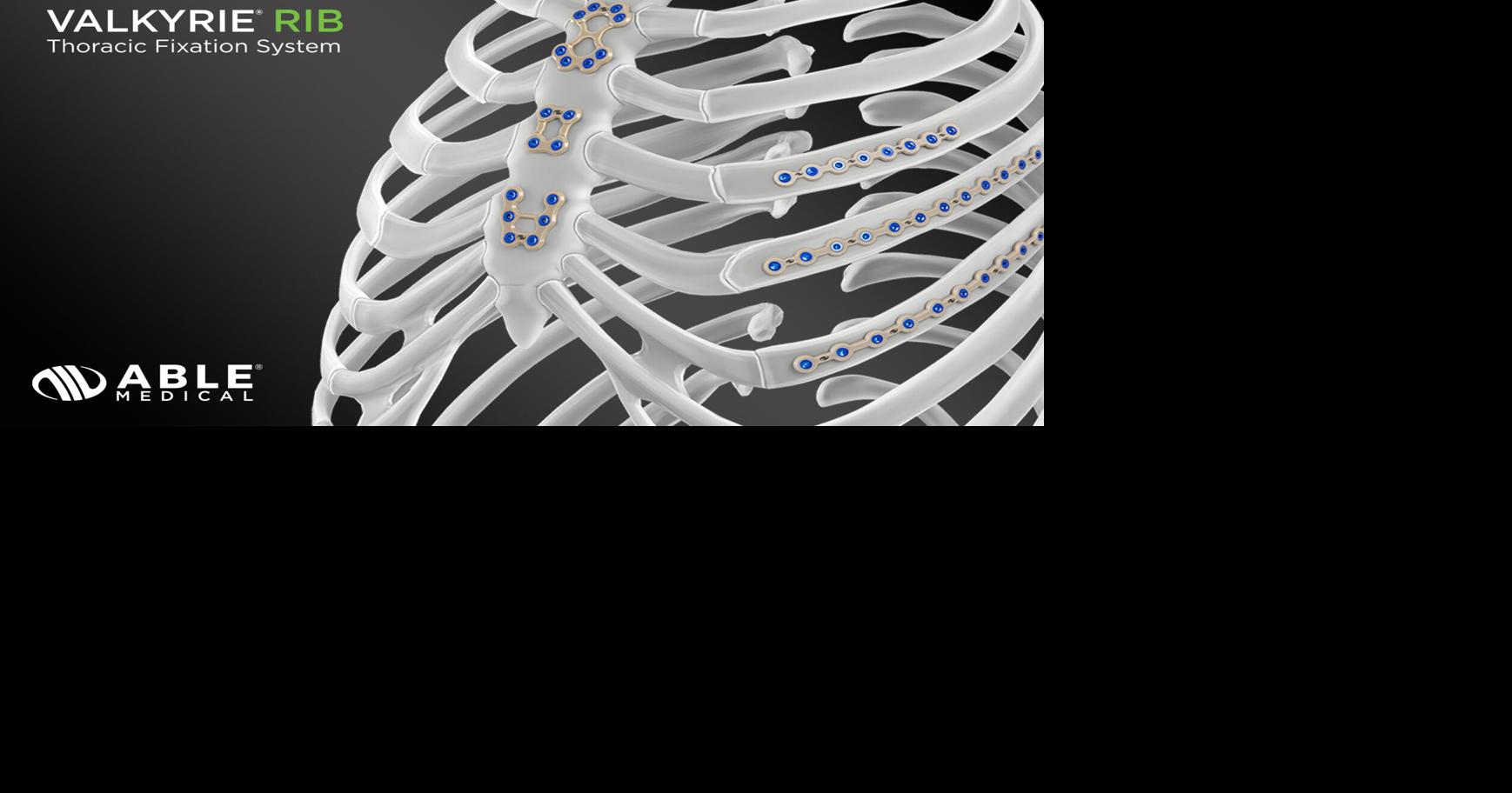 Able Medical to Showcase Industry’s First-to-Market PEEK Sternal Closure System at STS