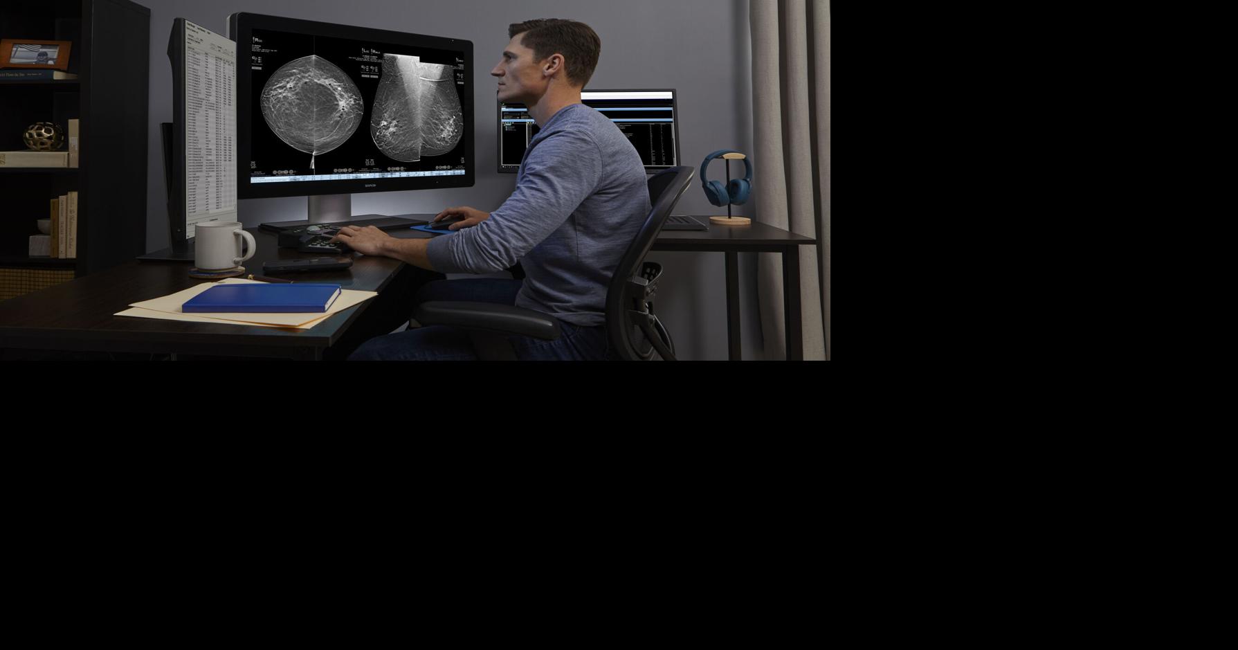 Hologic’s AI-Powered Mammography Technology Flagged a Third of Breast Cancer Cases Initially Interpreted as Negative in Study of 7,500 Screening Exams