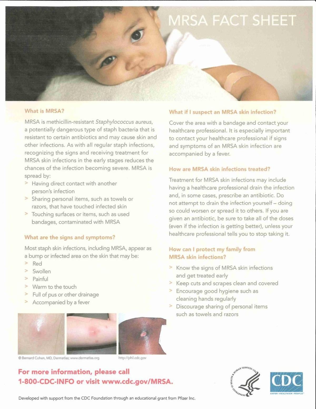 Mrsa Protocol Guidelines.pdf Hospital Protocol For Mrsa Patients – YVYMU