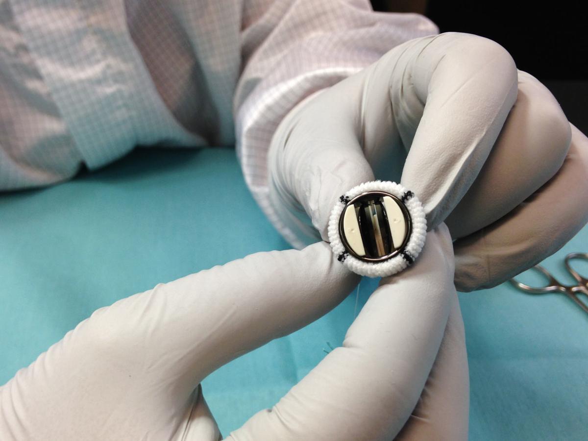 Pediatric heart valve invented by St. Jude Medical approved by FDA