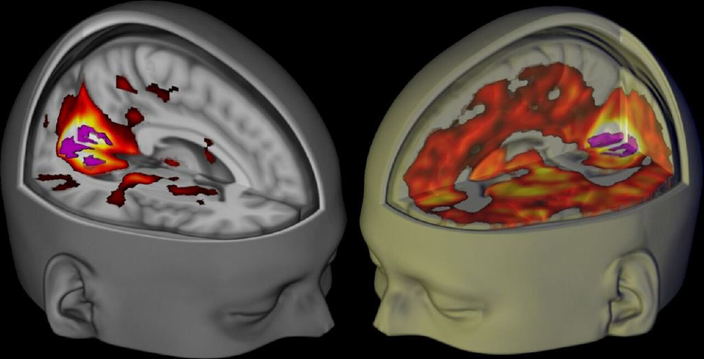 Linseed oil and its effect on our brain – Saint Charles