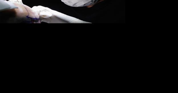 Turkish Hair Transplant 2024: Guide to Price and Considerations Before Making a Decision - Vimarsana News