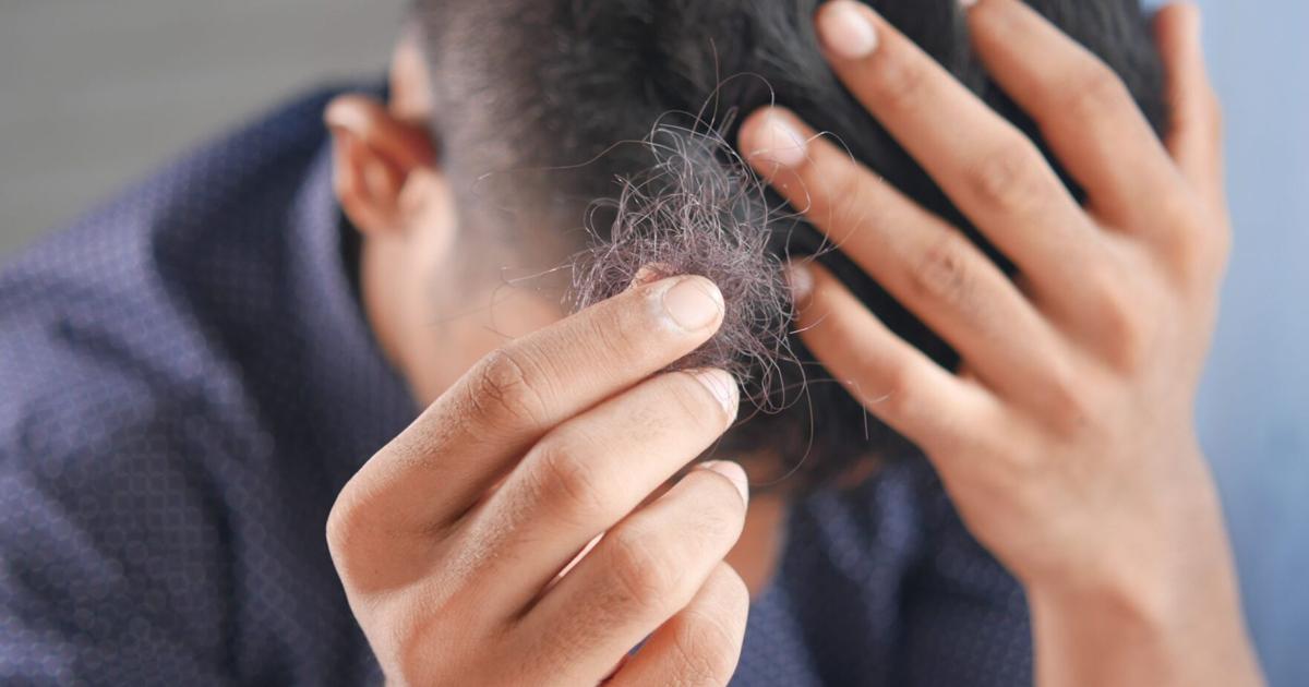 Losing Your Hair? Inno Supps’ Max Mane Targets the 9 Root Causes