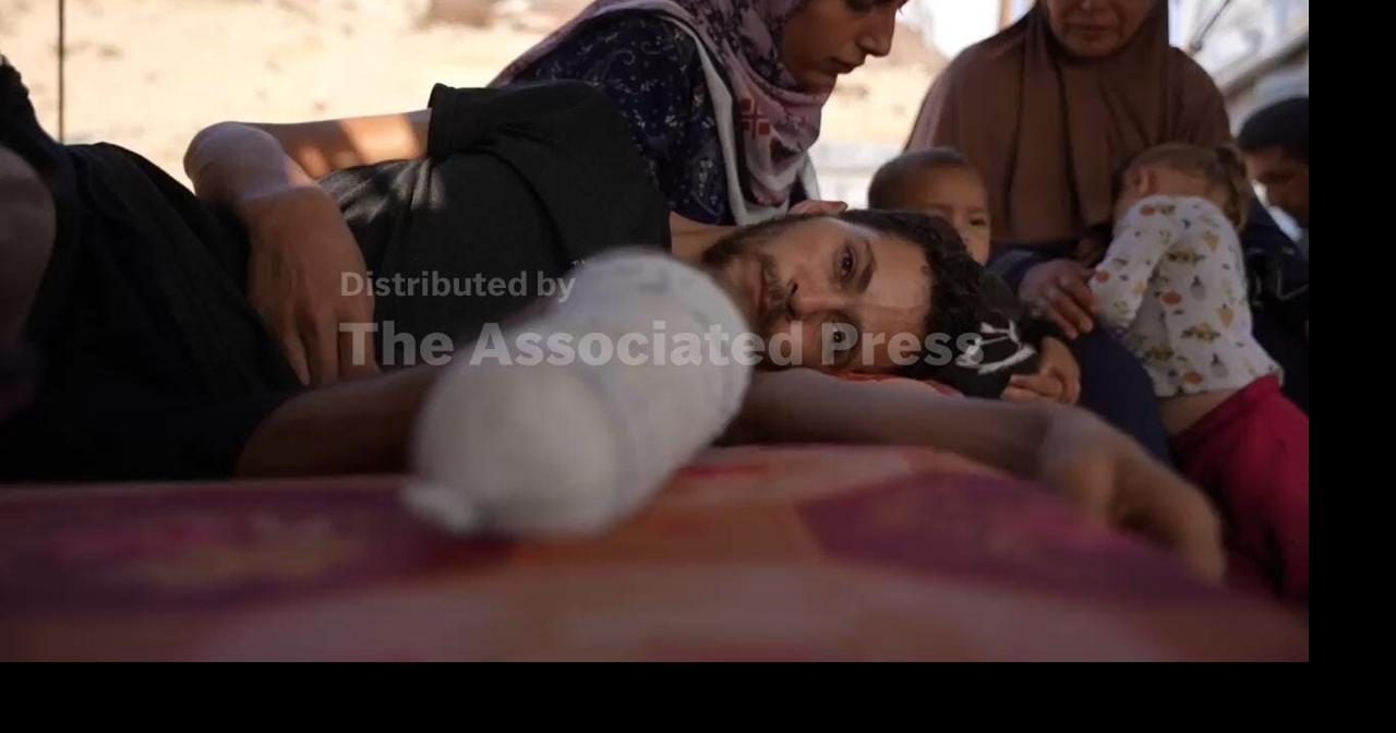 Gaza ceasefire slow to bring help for Palestinians who suffered amputations during war
