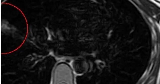 New Orleans native author releases book about her health care journey with lung cancer