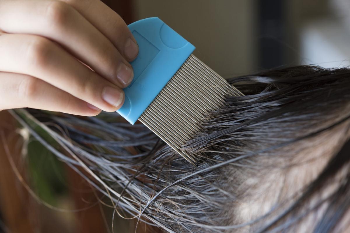 Parents Beware New OTC Resistant Lice Detected In Hair Health