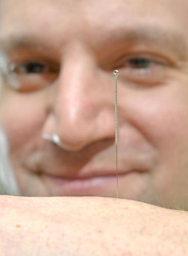 20 questions with acupuncturist Dr. Marc Obbink