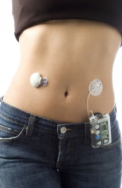  Insulin pumps make life easier for diabetics Special 