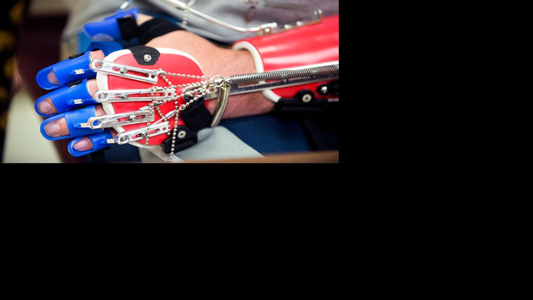 Devices help stroke patients regain hand, arm functionality Health
