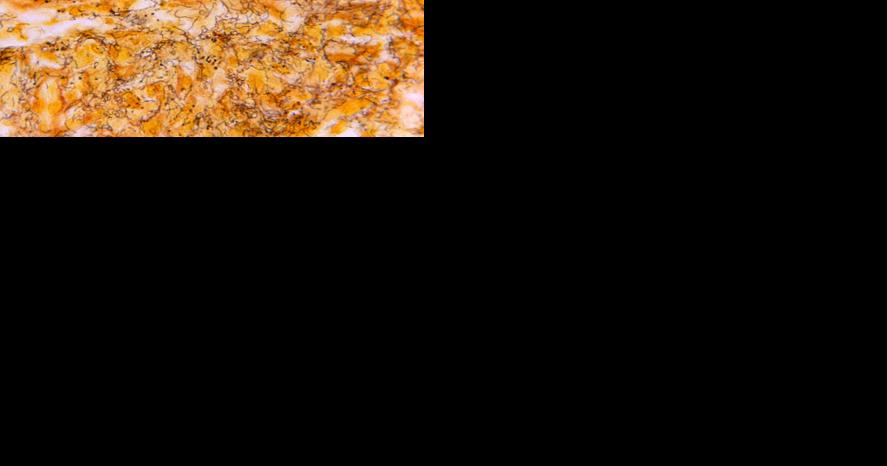 Syphilis cases in US newborns skyrocketed in 2022 - Vimarsana News
