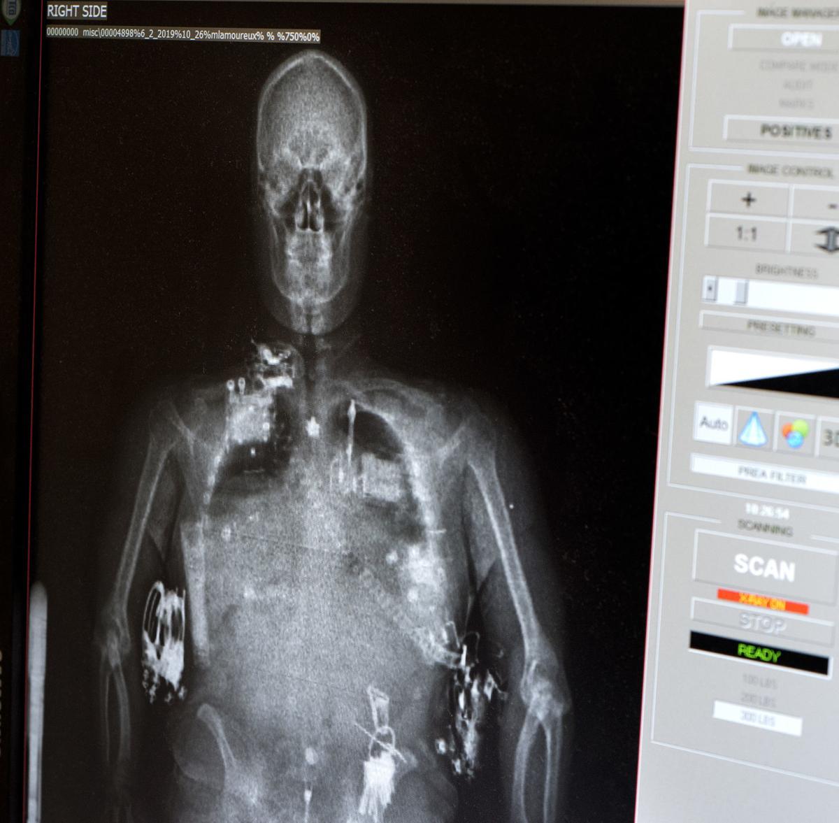 Wholebody imaging now used on Woodbury County Jail inmates