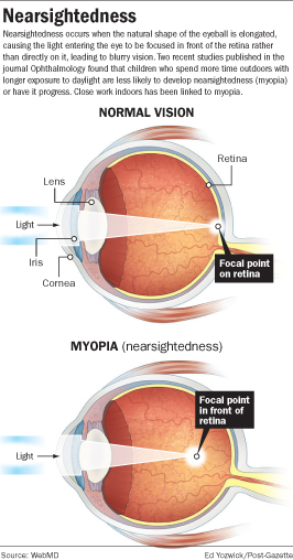 Playing outdoors lowers risk for nearsightedness in children | Health ...