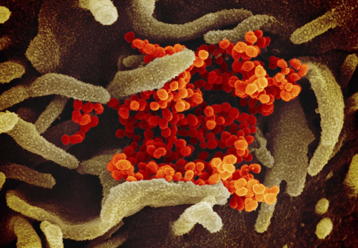 21 New Covid 19 Cases Reported In Dakota County Local News Siouxcityjournal Com