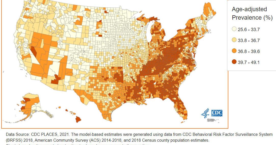Kentucky is one of the most sleep-deprived states - Vimarsana News