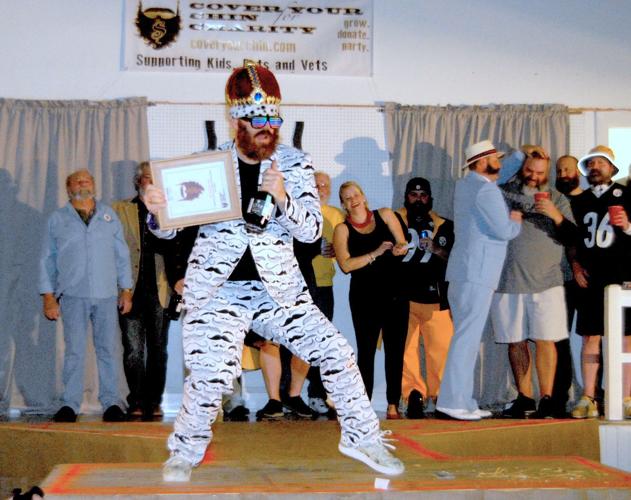 Cover Your Chin for Charity nets $30 K