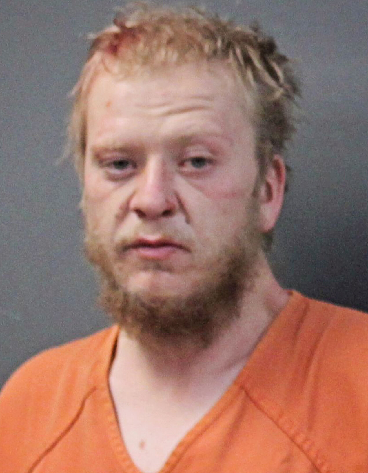 Scottsbluff man accused of seriously assaulting another man