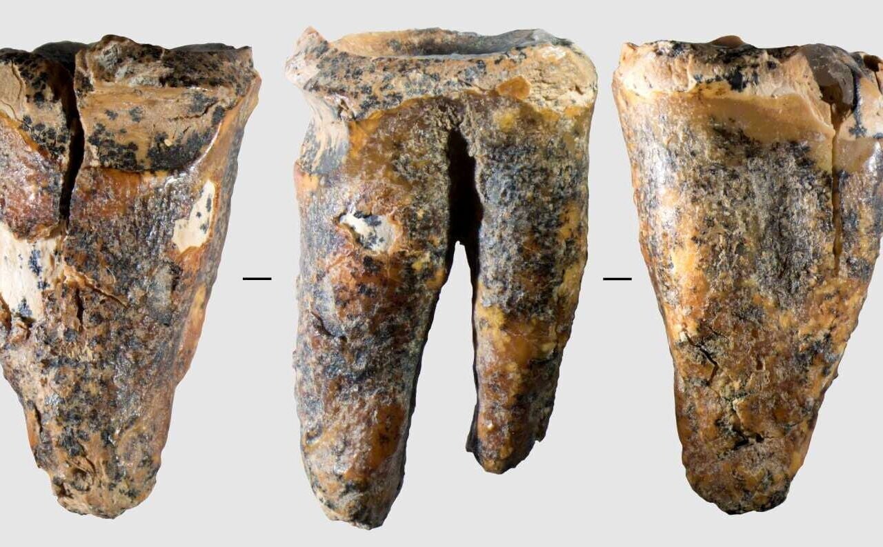 Tooth shows cavemen conducted dental surgery before anesthesia | Health ...