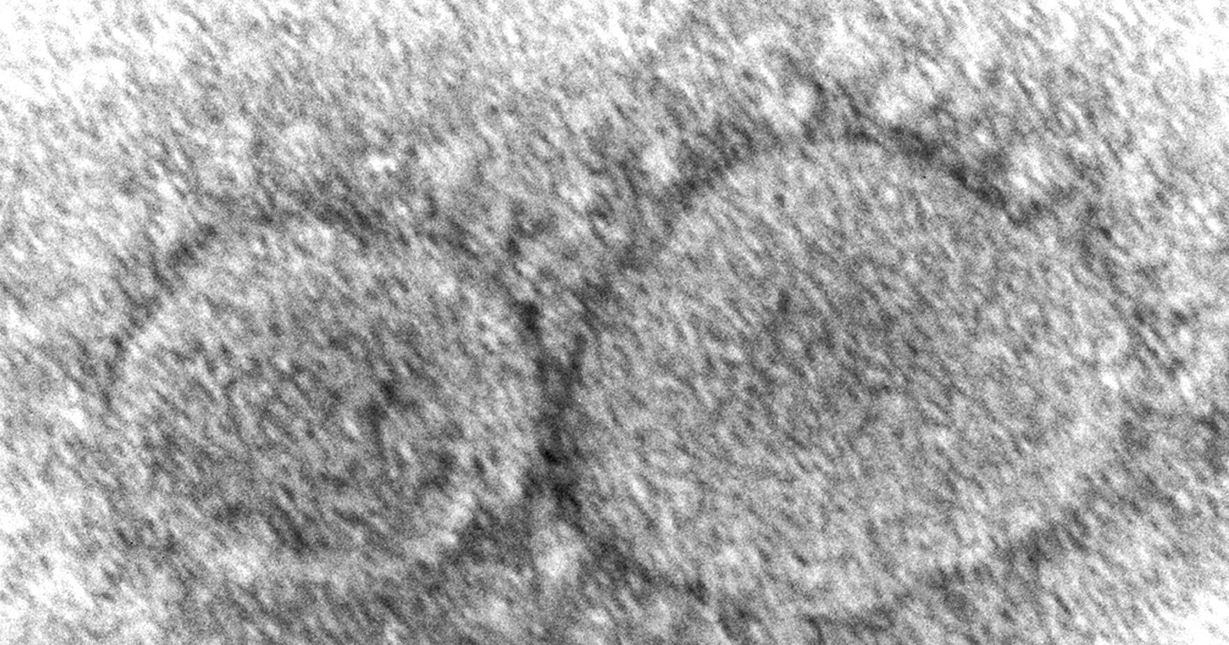 New COVID-19 subvariant KP.2 is dominant in Canada - Vimarsana News