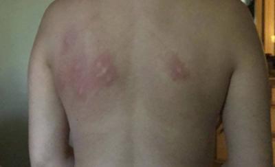 Amc Theater Denies Bedbug Claims Local News Stwnewspress Com