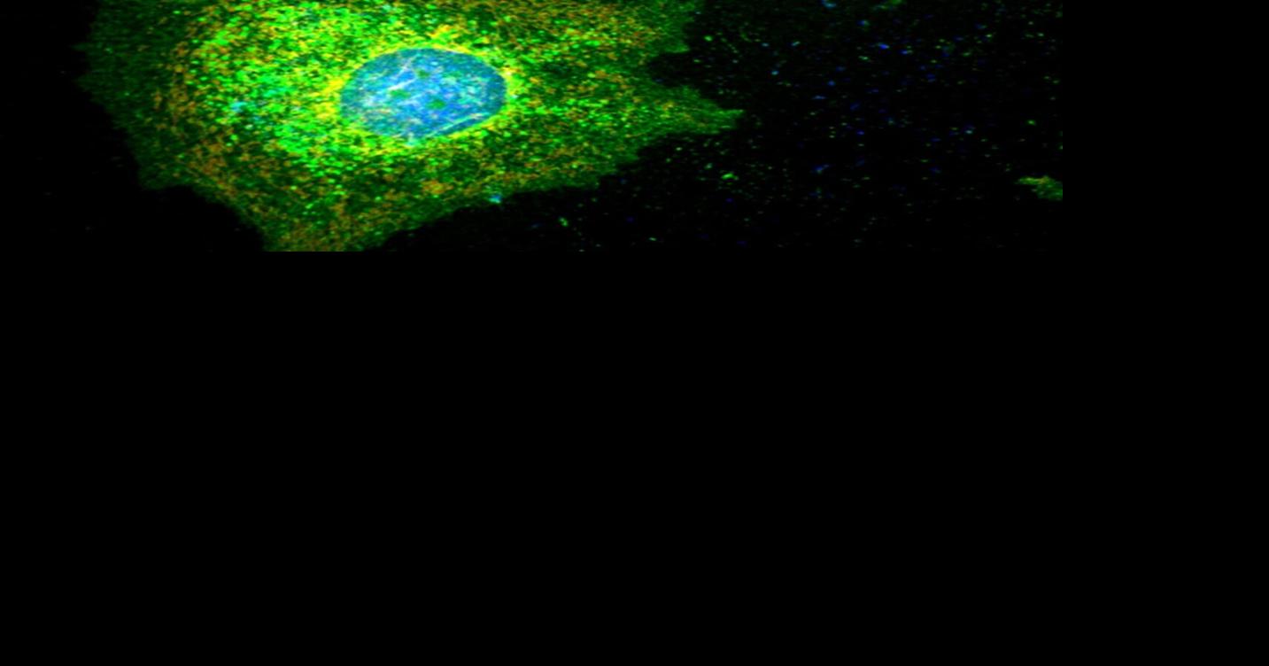 Scientists discover how tumors play dead to dodge chemotherapy | Nation ...
