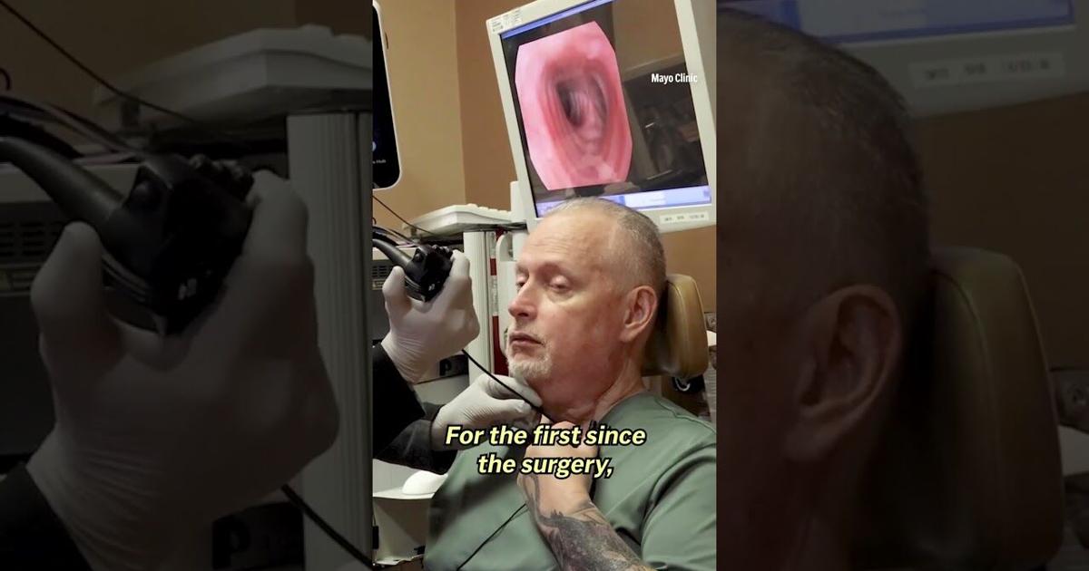 A rare voice box transplant helps cancer patient speak again ...