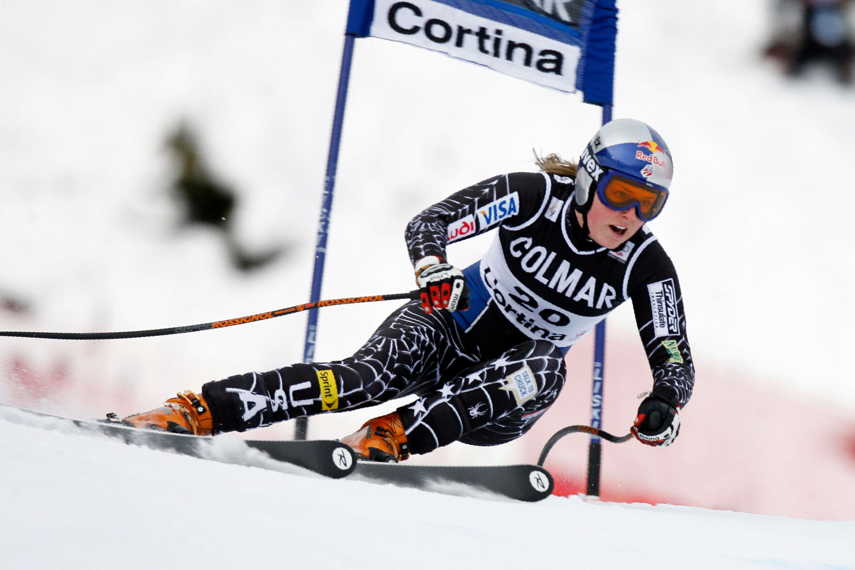 Vonn's decision is risky but 'possible,' experts say Sports