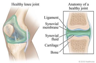 Osteoartritis ruku: simptomi i liječenje - Lumbago 
