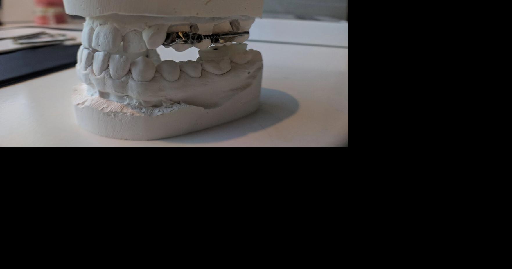 KFF HEALTH NEWS: FDA said it never inspected dental lab that made ...