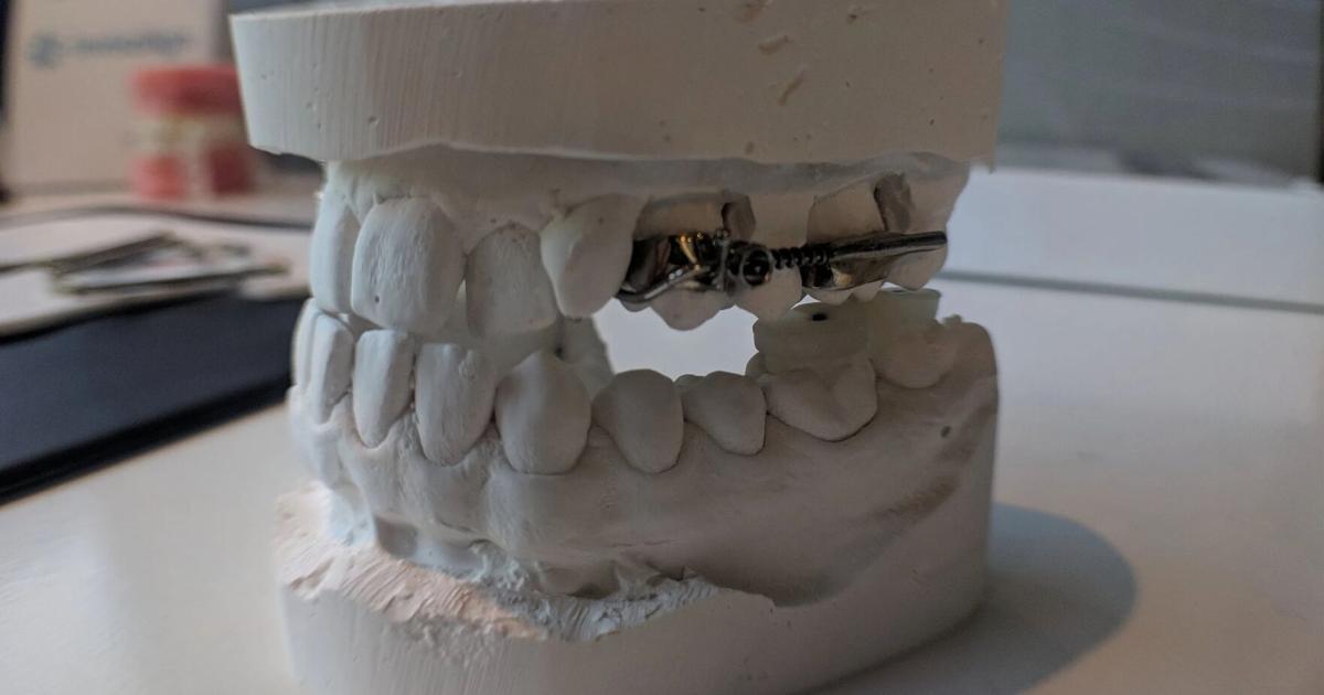 KFF HEALTH NEWS: FDA said it never inspected dental lab that made ...