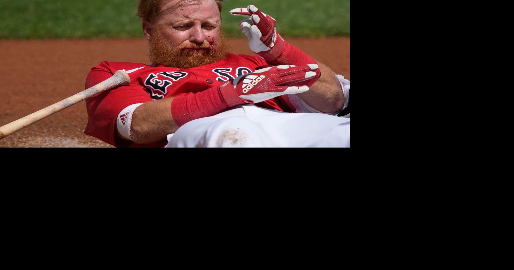 Justin Turner gets back in the batter's box for first time since being  struck in the face - The Boston Globe