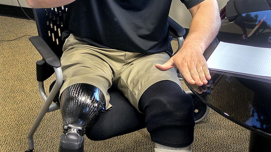 After double amputation, man learning to walk again | Local | tdn.com