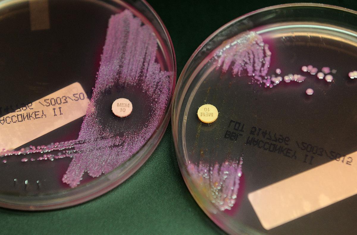 US-NEWS-SCI-SUPERBUGS-LA