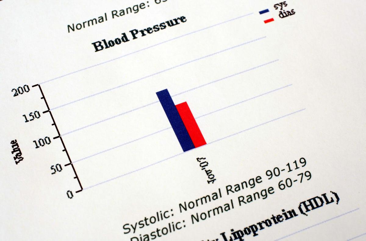 UCSD researchers created a pocket-size blood pressure monitor that