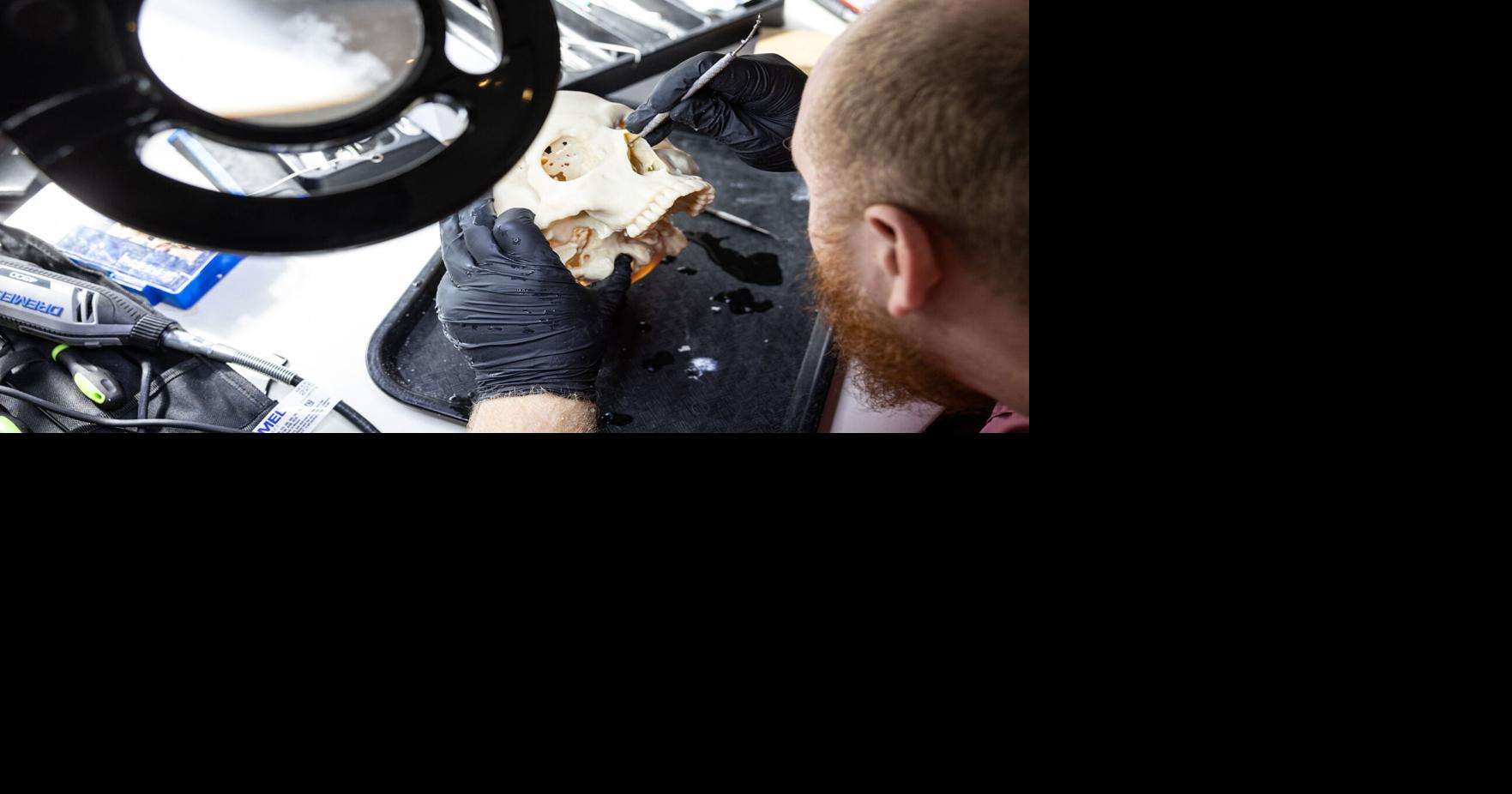 Austin Michaelis, lead additive manufacturing technician at MedCAD, uses a pick to scrape off excess resin left over from a 3 D printing process in a replica of a patientís scull on Sept. 22, 2025, in Dallas.