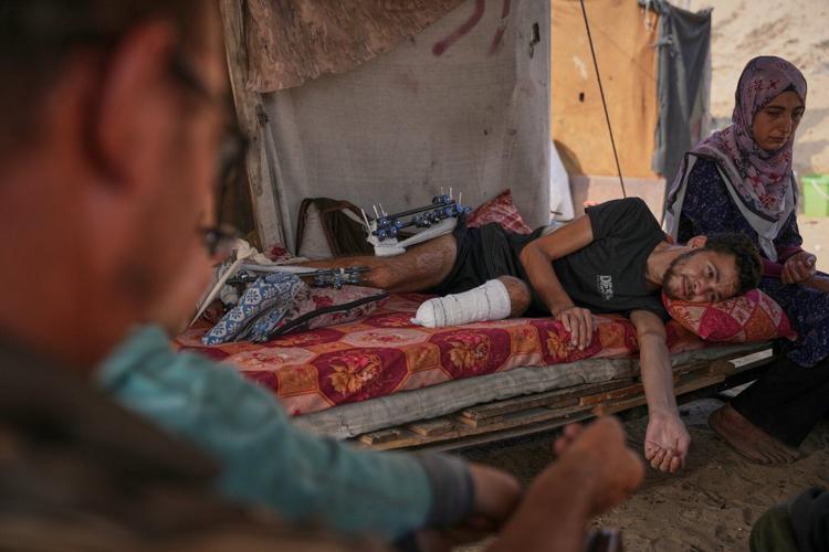 Photos of amputees in Gaza, struggling to survive after losing limbs to Israeli airstrikes
