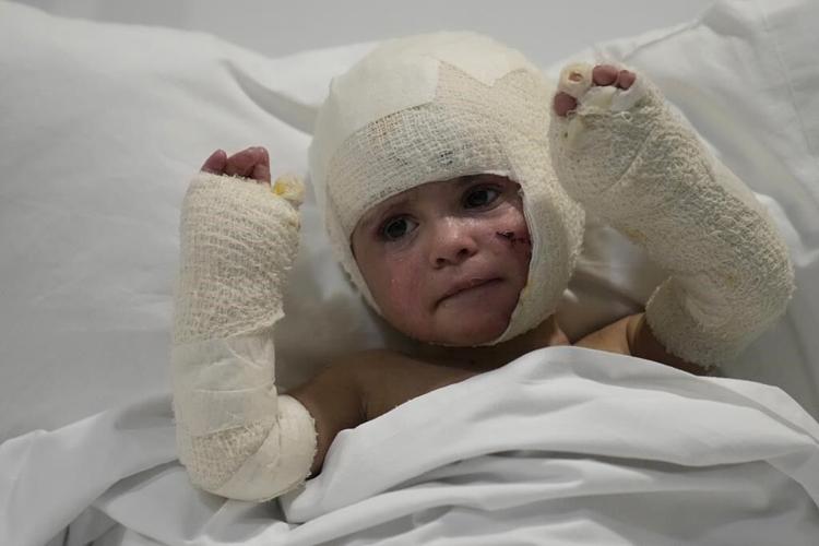 Traumatized by war, hundreds of Lebanon's children struggle with wounds both physical and emotional