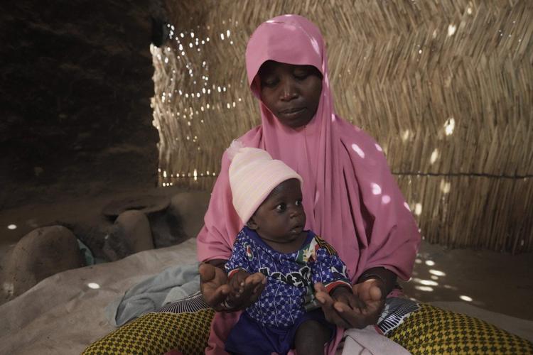 Children die as USAID aid cuts snap a lifeline for the world's most malnourished